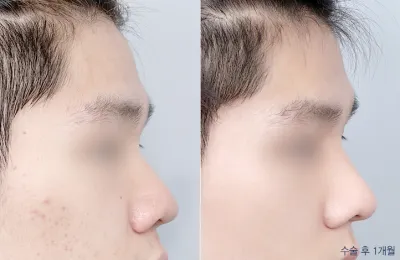 Before & After