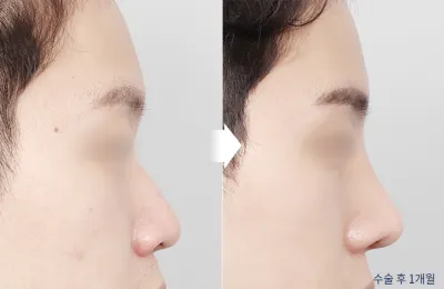 Before & After