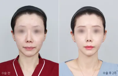 Before & After
