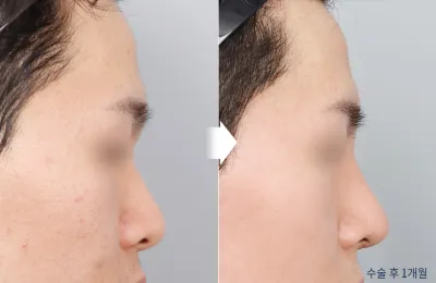 Before & After