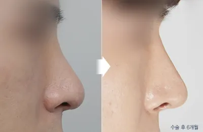 Before & After