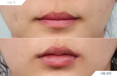 Before & After