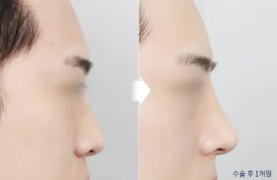 Before & After
