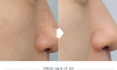 Before & After