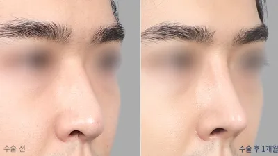 Before & After