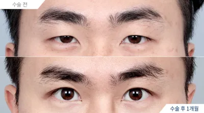 Before & After