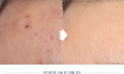Before & After