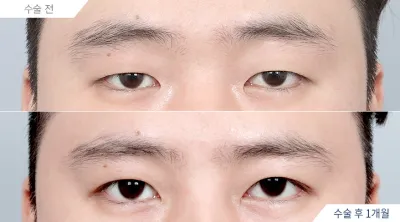 Before & After