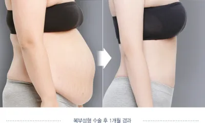 Before & After