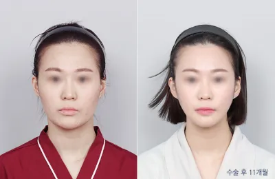 Before & After