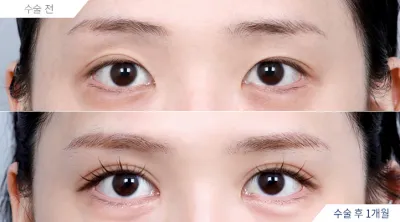 Before & After
