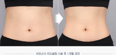 Before & After