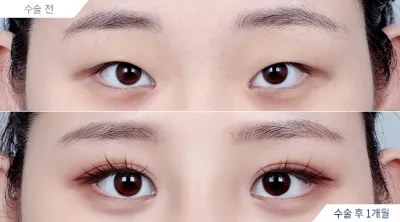 Before & After