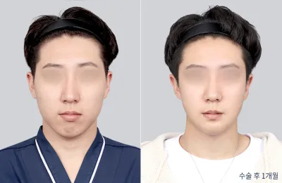 Before & After