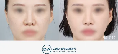 Before & After