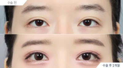 Before & After