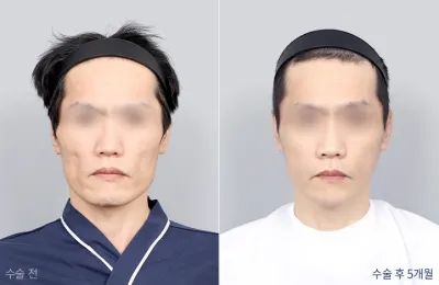 Before & After