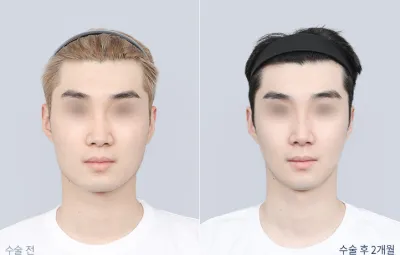 Before & After