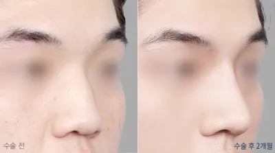 Before & After