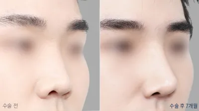 Before & After