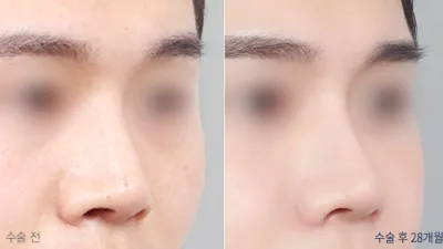 Before & After