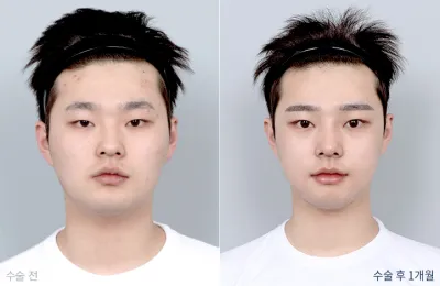 Before & After