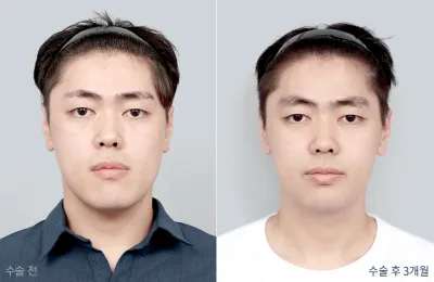 Before & After