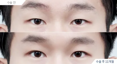 Before & After