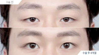 Before & After