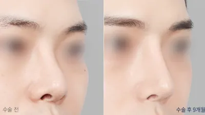 Before & After