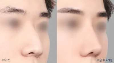 Before & After
