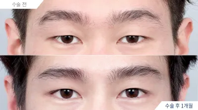 Before & After