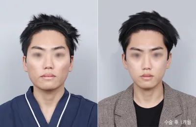 Before & After