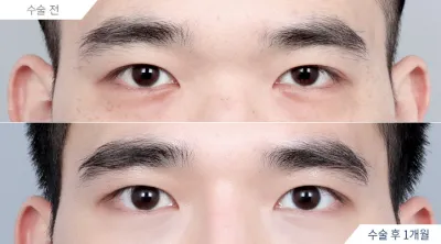 Before & After