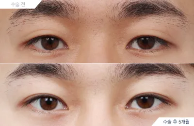 Before & After