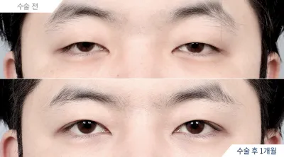 Before & After