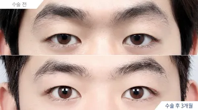 Before & After