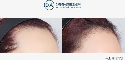 Before & After
