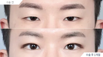 Before & After