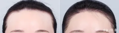 Before & After