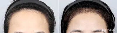 Before & After