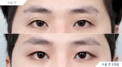 Before & After