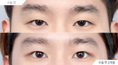 Before & After