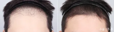 Before & After