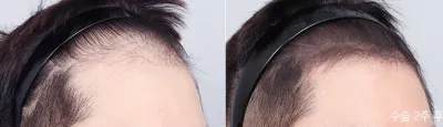 Before & After