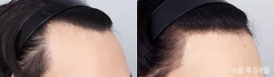 Before & After