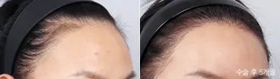 Before & After