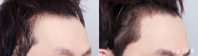 Before & After