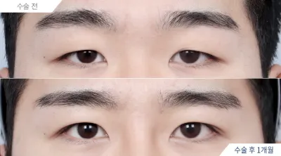 Before & After