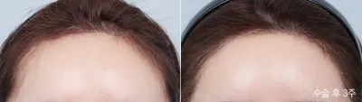 Before & After